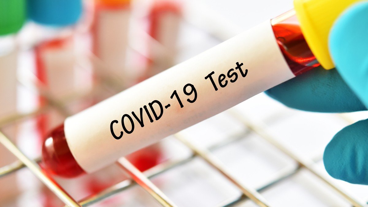 Eurofins County Pathology now set to deliver 5,000 COVID19 antibody
